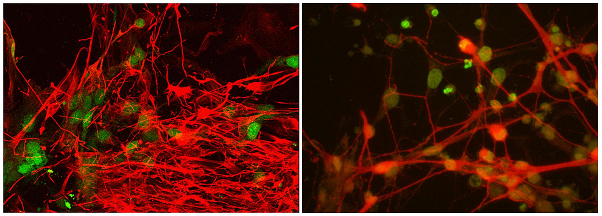 Neurons imaging