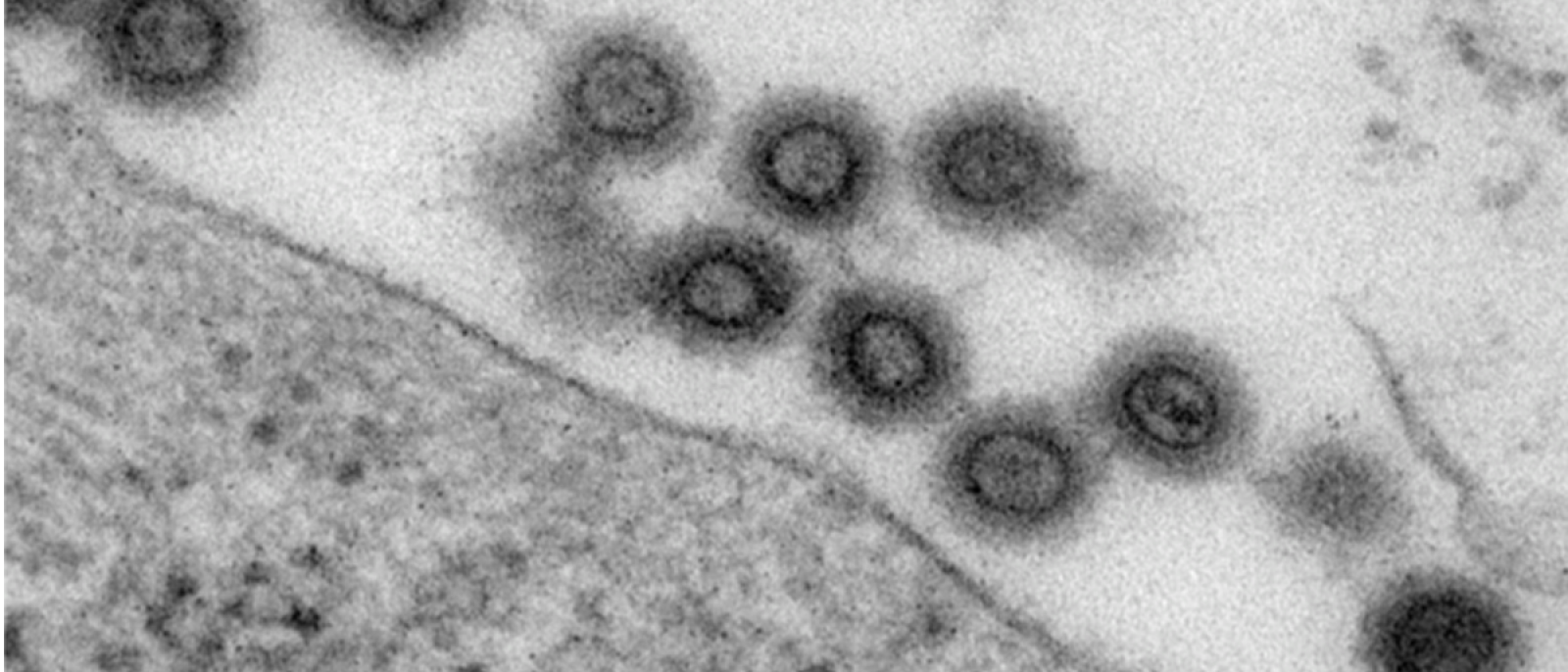 Luekemia Virus