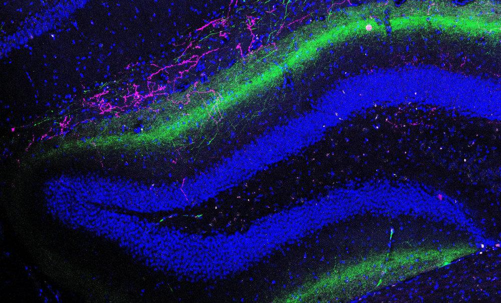 image of radiated cells